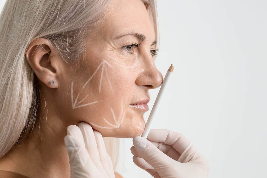 Customized Beauty with a Facelift Tailoring the Procedure to You